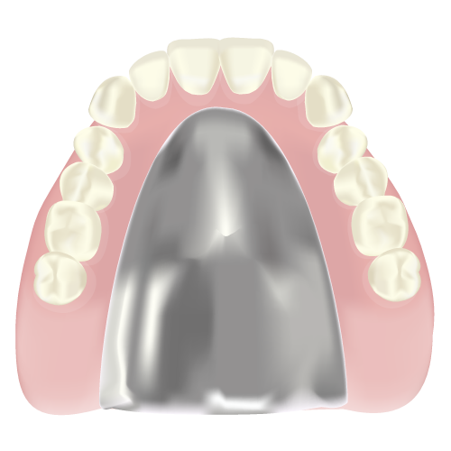 金属床義歯（自由診療）